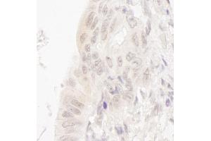 Immunohistochemistry (IHC) image for anti-Cancer Susceptibility Candidate 5 (CASC5) (AA 300-350) antibody (ABIN7448458)
