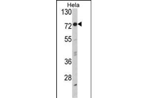 Western blot analysis of EIF2AK1 Antibody (Center) (ABIN392708 and ABIN2842185) in Hela cell line lysates (35 μg/lane).