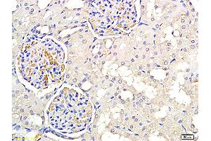 Formalin-fixed and paraffin embedded rat kidney labeled with Anti PNMT Polyclonal Antibody, Unconjugated (ABIN751033) at 1:300 followed by conjugation to the secondary antibody and DAB staining