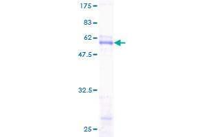 Image no. 1 for Sodium Channel Modifier 1 (SCNM1) (AA 1-230) protein (GST tag) (ABIN1319287) (SCNM1 Protein (AA 1-230) (GST tag))