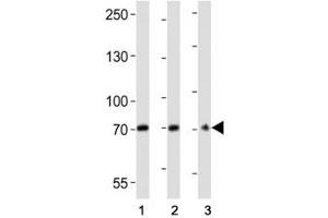 Western blot analysis of lysate from (1) U266, (2) HepG2 cell line, (3) mouse brain tissue lysate using CD73 antibody at 1:2000. (CD73 antibody  (AA 520-550))