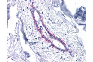 CDH1 antibody was used for immunohistochemistry at a concentration of 4-8 ug/ml. (E-cadherin antibody)