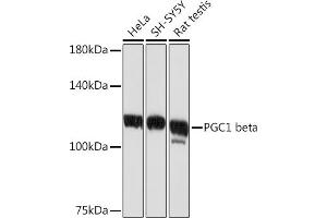 Western blot analysis of extracts of various cell lines, using PGC1 beta Rabbit mAb (ABIN1680494, ABIN3018825, ABIN3018826 and ABIN7101668) at 1:1000 dilution. (PPARGC1B antibody)