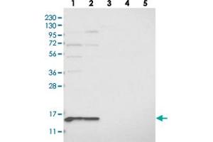 Western blot analysis of Lane 1: RT-4, Lane 2: U-251 MG, Lane 3: Human Plasma, Lane 4: Liver, Lane 5: Tonsil with MRPL41 polyclonal antibody  at 1:250-1:500 dilution.