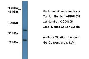 WB Suggested Anti-Clns1a  Antibody Titration: 0. (CLNS1A antibody  (C-Term))