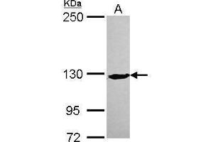 XPC antibody  (C-Term)