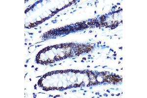Immunohistochemistry of paraffin-embedded human colon using Lamin B1 Rabbit mAb (ABIN7268180) at dilution of 1:100 (40x lens). (Lamin B1 antibody)