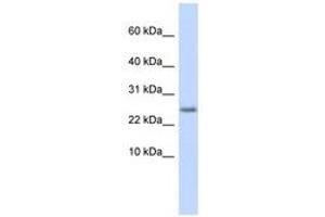 Image no. 1 for anti-Cystatin 9 (Testatin) (CST9) (C-Term) antibody (ABIN6740885) (CST9 antibody  (C-Term))