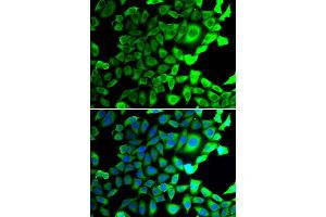 Immunofluorescence analysis of A549 cell using USP8 antibody. (USP8 antibody)
