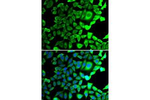 Immunofluorescence analysis of A549 cell using USP8 antibody.