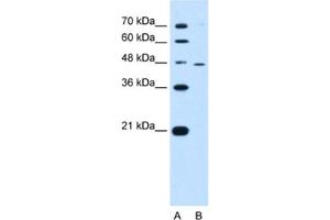 Western Blotting (WB) image for anti-Ring Finger Protein 25 (RNF25) antibody (ABIN2462680) (RNF25 antibody)