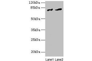 Western blot All lanes: FAM161A antibody at 8 μg/mL Lane 1: Human placenta tissue Lane 2: Mouse liver tissue Secondary Goat polyclonal to rabbit IgG at 1/10000 dilution Predicted band size: 77, 65, 84 kDa Observed band size: 77 kDa (FAM161A antibody  (AA 1-300))