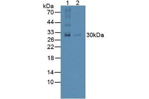 Figure. (RANKL antibody  (AA 79-247))