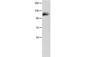 Western Blot analysis of Mouse lung tissue using Amphiphysin I Polyclonal Antibody at dilution of 1:500 (Amphiphysin antibody)