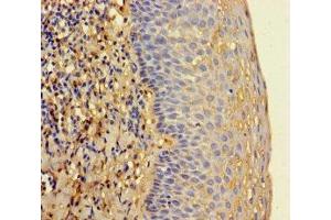Immunohistochemistry of paraffin-embedded human tonsil tissue using ABIN7142130 at dilution of 1:100 (RNASEL antibody  (AA 330-741))