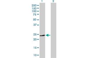 Western Blot analysis of CD74 expression in transfected 293T cell line by CD74 MaxPab polyclonal antibody. (CD74 antibody  (AA 1-160))