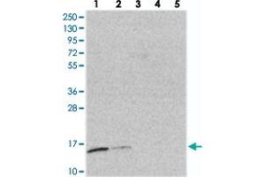 Western blot analysis of Lane 1: RT-4, Lane 2: U-251 MG, Lane 3: Human Plasma, Lane 4: Liver, Lane 5: Tonsil with TRAPPC2L polyclonal antibody  at 1:250-1:500 dilution. (TRAPPC2L antibody)