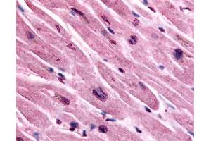 Immunohistochemical (Formalin/PFA-fixed paraffin-embedded sections) staining of human heart with CHRM3 polyclonal antibody . (CHRM3 antibody)