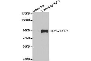 Western blot analysis of extracts from Jurkat cells,using phospho-VAV1-Y174 antibody (ABIN2987533). (VAV1 antibody  (pTyr174))