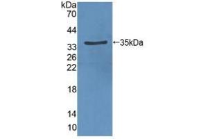 Detection of Recombinant VEGFR2, Rat using Polyclonal Antibody to Vascular Endothelial Growth Factor Receptor 2 (VEGFR2) (VEGFR2/CD309 antibody  (AA 46-320))