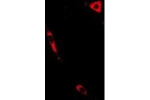 Immunofluorescent analysis of PTGES2 staining in A549 cells. (PTGES2 antibody)