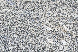 IHC analysis of HOXD11 using anti-HOXD11 antibody (ABIN7603174). (HOXD11 antibody  (N-Term))