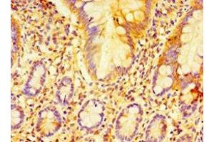 Immunohistochemistry of paraffin-embedded human small intestine tissue using ABIN7152225 at dilution of 1:100