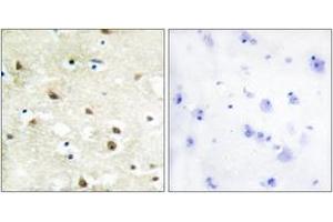 Immunohistochemistry analysis of paraffin-embedded human brain tissue, using hnRNP C1/C2 Antibody. (HNRNPC antibody  (AA 241-290))