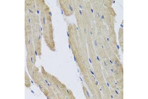 Immunohistochemistry of paraffin-embedded mouse heart using PRPH antibody at dilution of 1:100 (x40 lens). (Peripherin antibody)