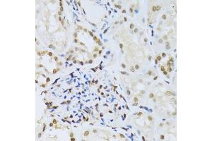 Immunohistochemistry of paraffin-embedded human kidney using MAPK3 Antibody. (ERK1 antibody)