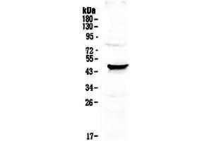 Western blot analysis of NOV/CCN3 using anti-NOV/CCN3 antibody .