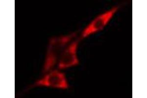 ABIN6267518 staining HeLa cells by IF/ICC.