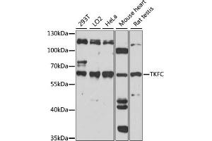 Western blot analysis of extracts of various cell lines, using TKFC antibody (ABIN7266775). (DAK antibody  (AA 226-575))