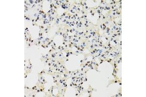 Immunohistochemistry of paraffin-embedded mouse lung using KDM4A antibody (ABIN5975678) at dilution of 1/100 (40x lens). (KDM4A antibody)
