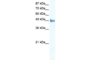 WB Suggested Anti-MAP3K8 Antibody Titration: 2. (MAP3K8 antibody  (C-Term))
