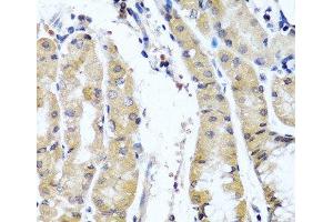Immunohistochemistry of paraffin-embedded Human stomach using COL9A1 Polyclonal Antibody at dilution of 1:100 (40x lens).
