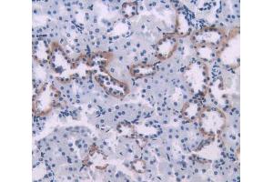 Used in DAB staining on fromalin fixed paraffin- embedded kidney tissue (PIM1 antibody  (AA 38-177))