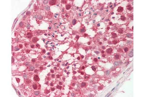 Platelet-Derived Growth Factor CC (PDGFCC) (N-Term) antibody