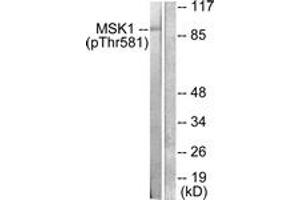 Western blot analysis of extracts from RAW264. (MSK1 antibody  (pThr581))