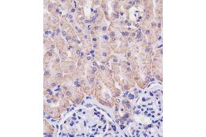 (ABIN654111 and ABIN2843993) staining SLC3A2 in human kidney tissue sections by Immunohistochemistry (IHC-P - paraformaldehyde-fixed, paraffin-embedded sections). (SLC3A2 antibody  (C-Term))