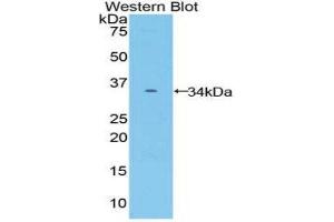 Western Blotting (WB) image for anti-Frizzled Family Receptor 10 (FZD10) (AA 235-495) antibody (ABIN2118061) (FZD10 antibody  (AA 235-495))