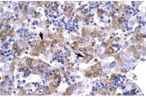 Human Liver; Rabbit Anti-POU1F1 Antibody. (POU1F1 antibody  (C-Term))