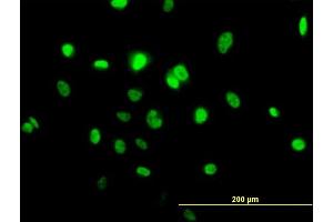 Immunofluorescence of purified MaxPab antibody to TOB1 on HeLa cell.