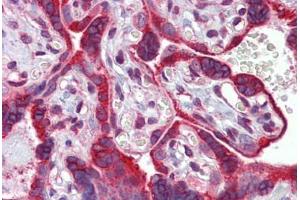 Placenta, Human: Formalin-Fixed, Paraffin-Embedded (FFPE) (Calnexin antibody)