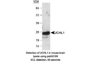 Image no. 1 for anti-Ubiquitin Carboxyl-terminal Esterase L1 (Ubiquitin Thiolesterase) (UCHL1) (AA 100-200) antibody (ABIN363498) (UCHL1 antibody  (AA 100-200))