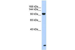 WB Suggested Anti-TNRC6B Antibody Titration:  0. (TNRC6B antibody  (N-Term))