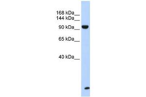WB Suggested Anti-TNRC6B Antibody Titration:  0.