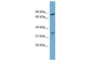 APEH antibody used at 1 ug/ml to detect target protein.