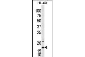 IL1F5 Antibody (N-term) (ABIN656238 and ABIN2845554) western blot analysis in HL-60 cell line lysates (35 μg/lane).