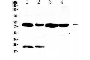 UGT1A1 antibody  (AA 316-533)